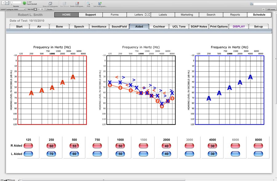 Audiogram Aided - Audiograms