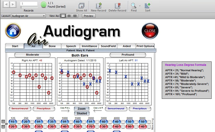 Audiogram Air (Bone Link) - Audiograms