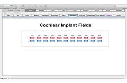 Audiogram Cochlear - Audiograms