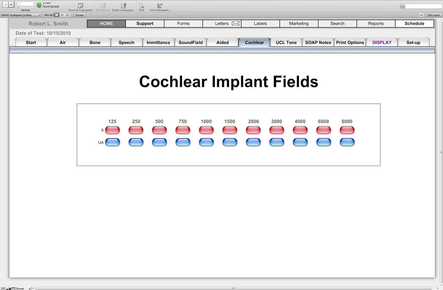 Audiogram Cochlear - Audiograms