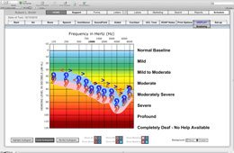 Audiogram Display - Audiograms