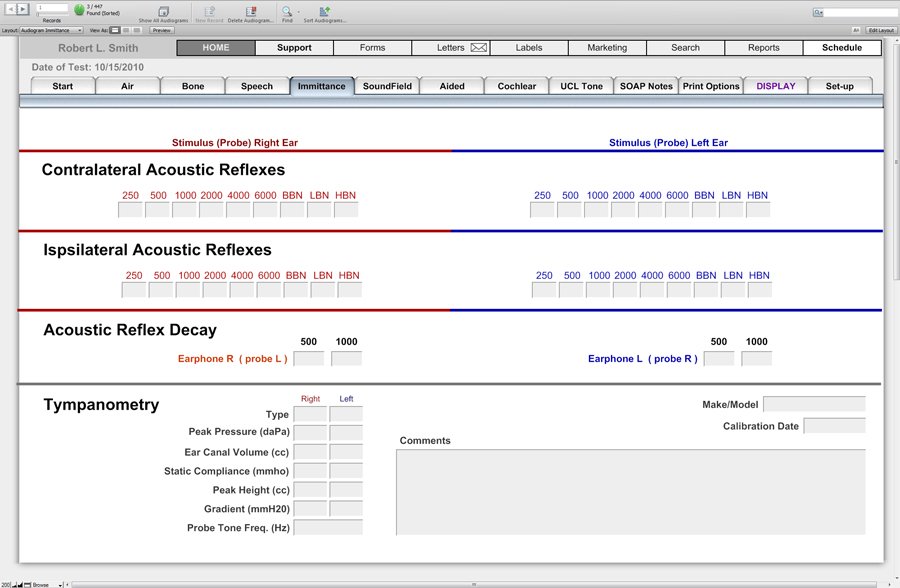 Audiogram Immittance - Audiograms