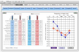 Audiogram Set-up Symbols - Audiograms