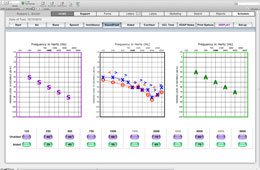 Audiogram Soundfield - Audiograms