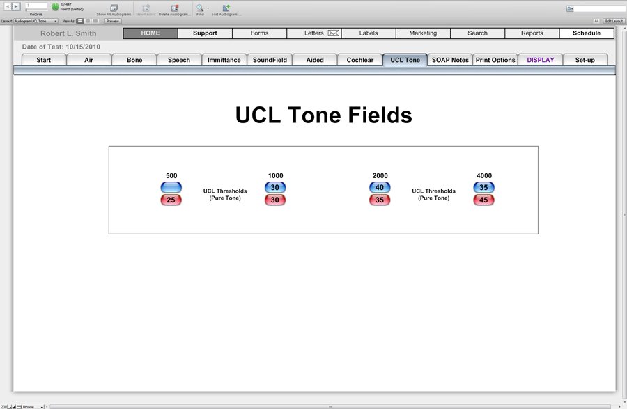 Audiogram UCL Tone - Audiograms